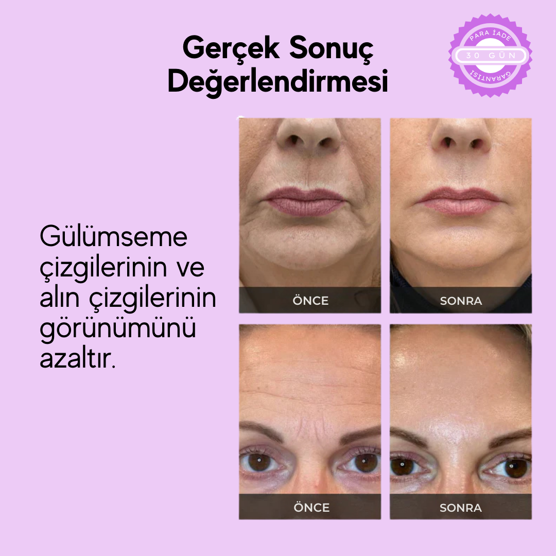 GlowFirm – Dakikalar İçinde Pürüzsüzleştirin, Sıkılaştırın ve Tazeleyin